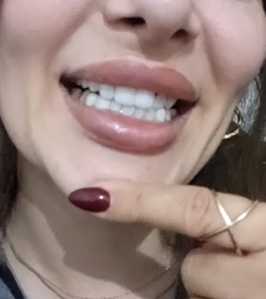 Diş Tedavi Odası
